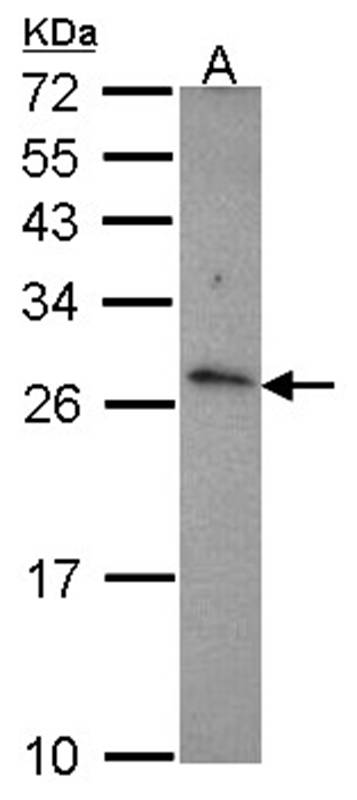 CD27L(CD27L(CD70)) antibody