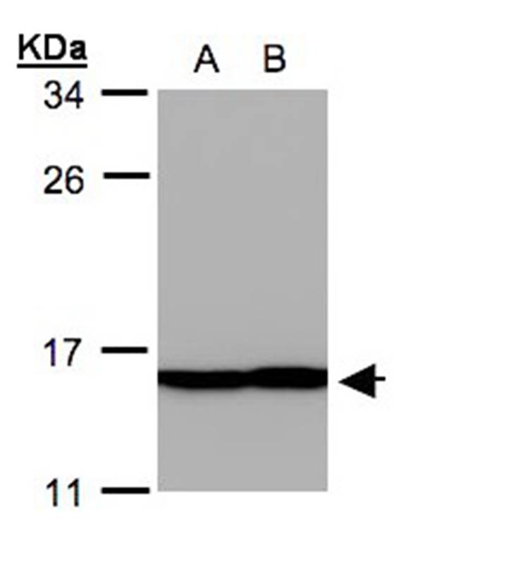 Profilin 2 antibody