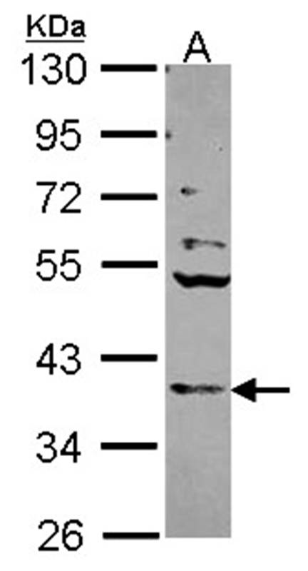 Cathepsin S antibody
