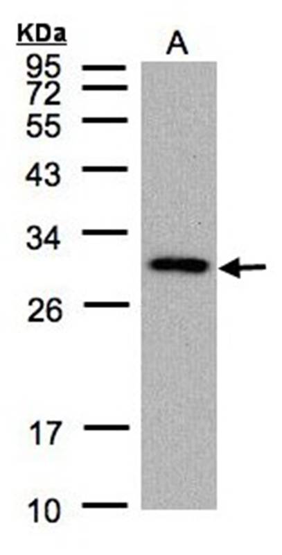 CTDSP2 antibody
