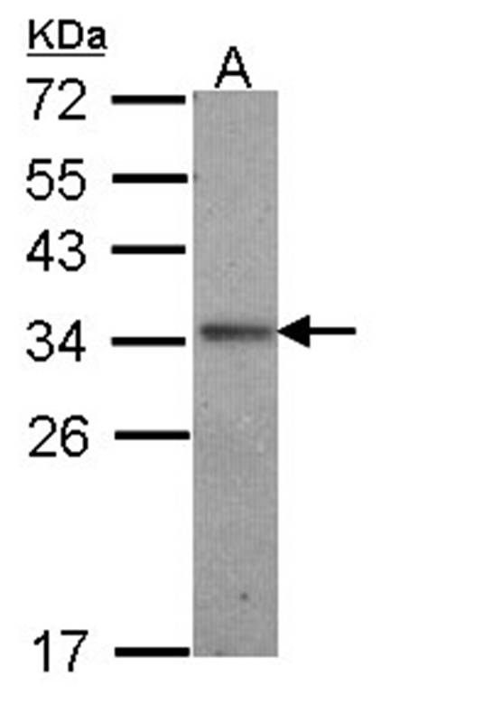 Interleukin-24 antibody