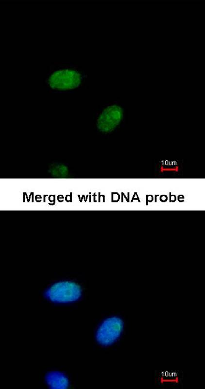 E2F1 antibody