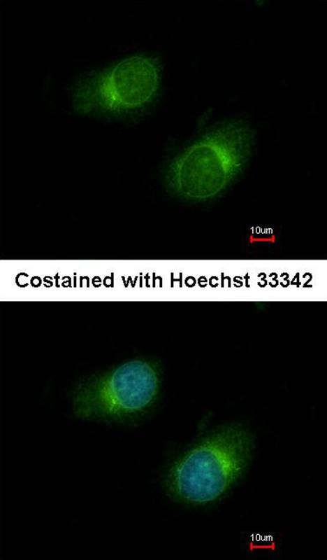 Collagen III antibody