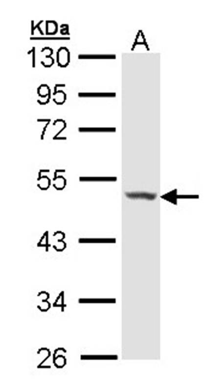 Haptoglobin antibody