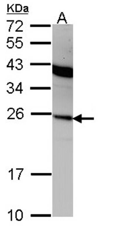 Interferon alpha-2 antibody