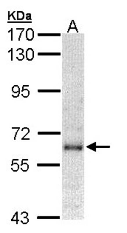 interferon-alpha receptor 1 antibody