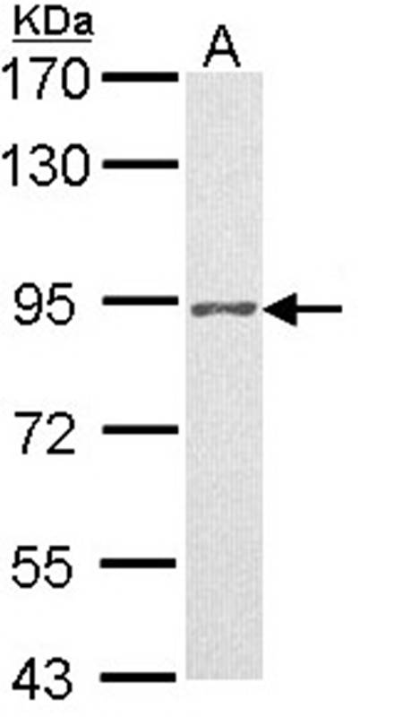 Progesterone receptor antibody