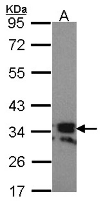 RANKL(CD254) antibody