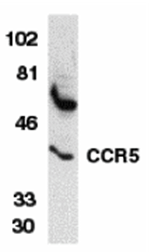 CCR5 Antibody