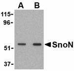 SnoN Antibody