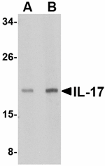 IL-17 Antibody