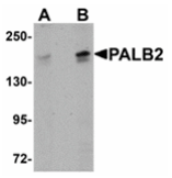 PALB2 Antibody