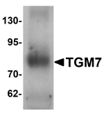 TGM7 Antibody