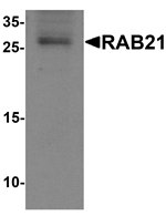 RAB21 Antibody