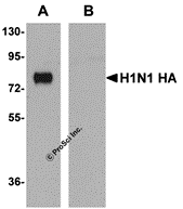 Seasonal H1N1 Hemagglutinin Monoclonal Antibody