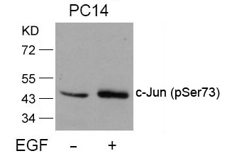 c-Jun(Phospho-Ser73) Antibody