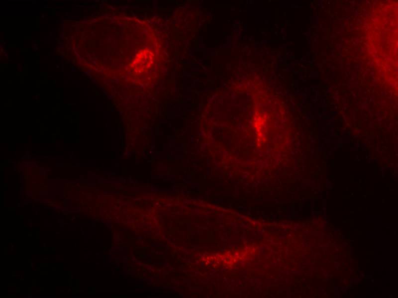 GSK3a(Phospho-Ser21) Antibody