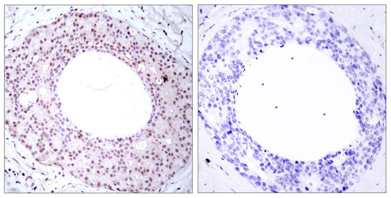 NFkB-p65(Phospho-Thr254) Antibody