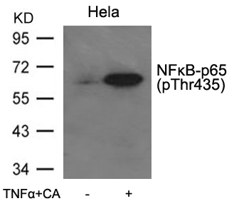 NFkB-p65(Phospho-Thr435) Antibody