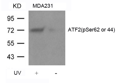 ATF2(Phospho-Ser62 or 44) Antibody