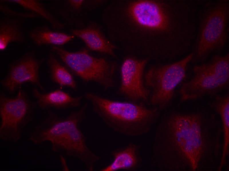 ATF2(Phospho-Thr73 or 55) Antibody