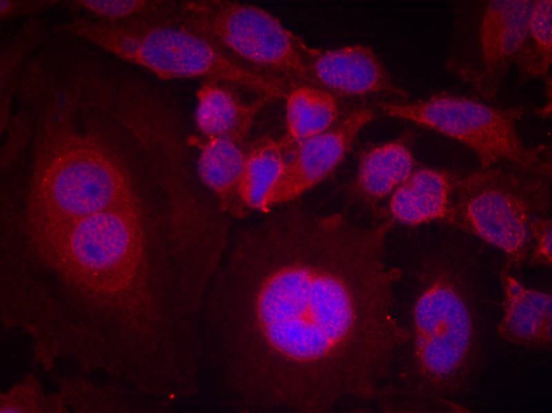 STAT3(Phospho-Ser727) Antibody