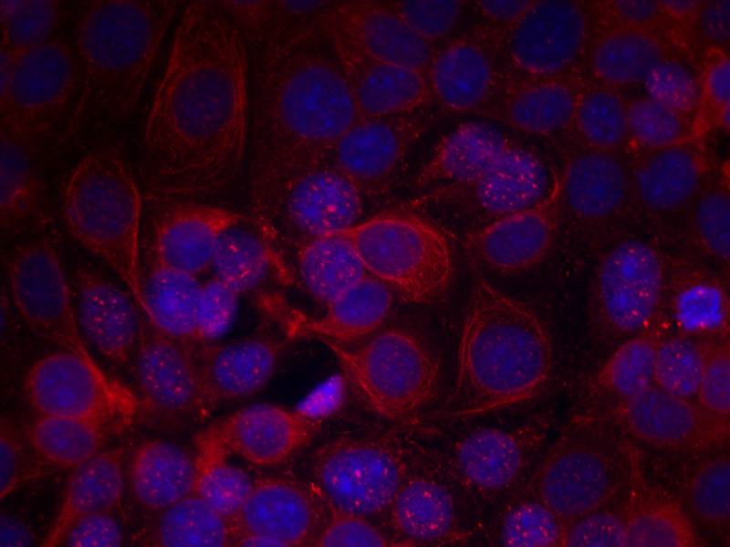 HER2(Phospho-Tyr1221/Tyr1222) Antibody