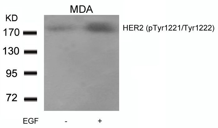 HER2(Phospho-Tyr1221/Tyr1222) Antibody