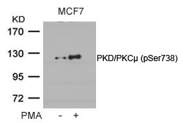 PKD/PKCm(Phospho-Ser738) Antibody