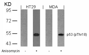 p53(Phospho-Thr18) Antibody