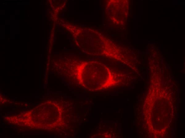 p53(Phospho-Ser46) Antibody