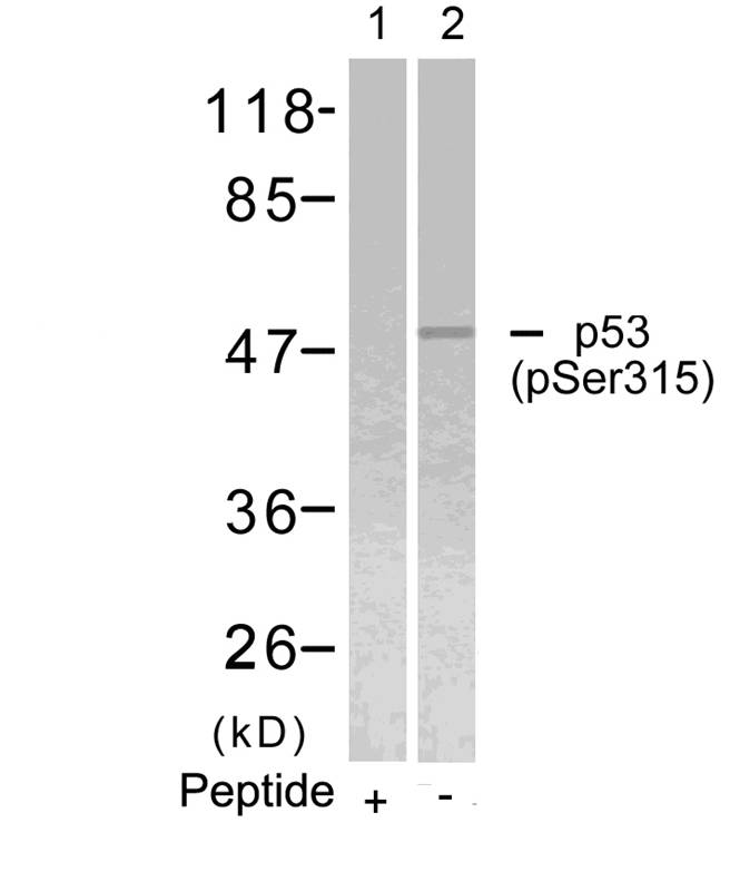 p53(Phospho-Ser315) Antibody