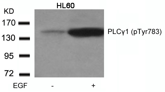 PLCgamma1(Phospho-Tyr783) Antibody