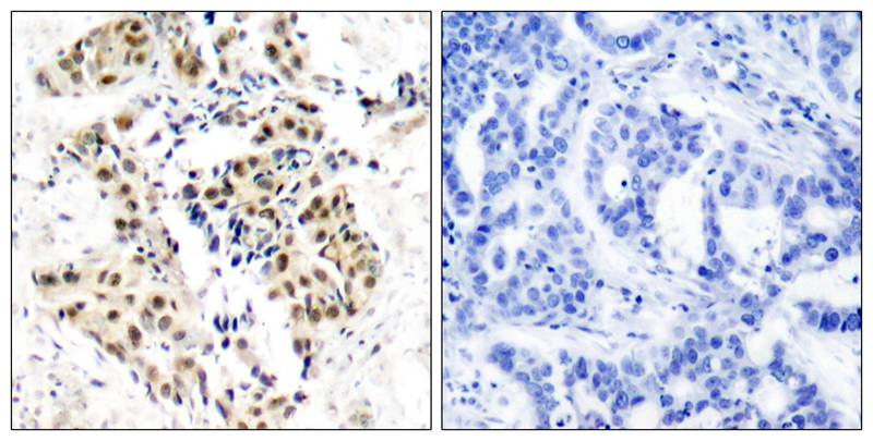 ATM(Phospho-Ser1981) Antibody