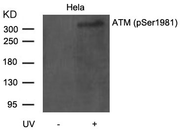 ATM(Phospho-Ser1981) Antibody