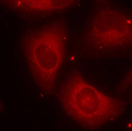 LIMK2(Phospho-Thr505) Antibody