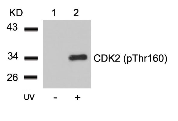 CDK2(Phospho-Thr160) Antibody