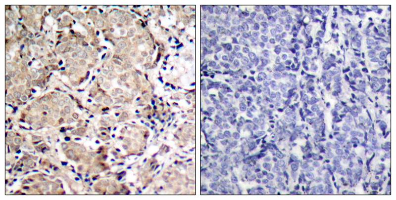 FKHR(Phospho-Ser319) Antibody