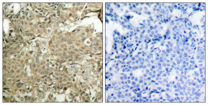 cofilin(Phospho-Ser3) Antibody