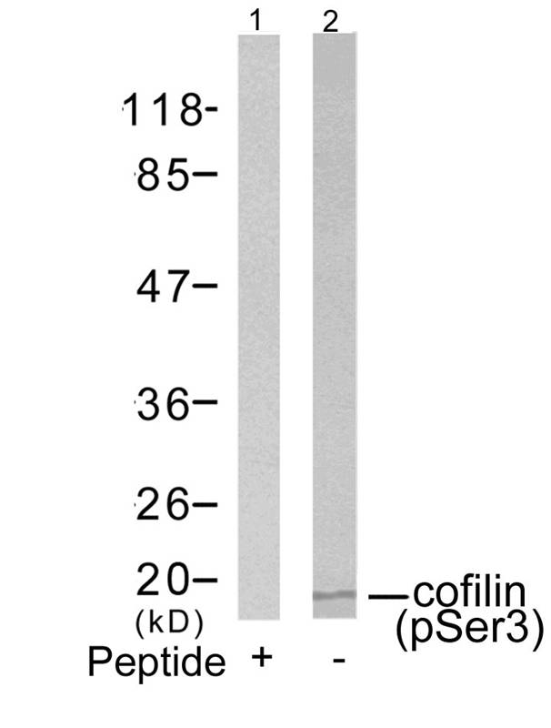 cofilin(Phospho-Ser3) Antibody