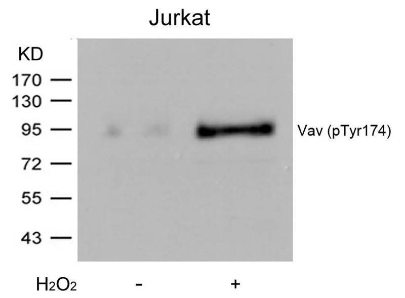 Vav(Phospho-Tyr174) Antibody