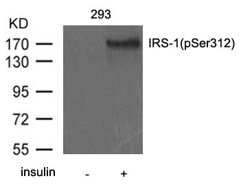 IRS-1(Phospho-Ser312) Antibody
