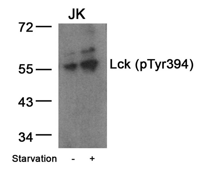 Lck(Phospho-Tyr394) Antibody