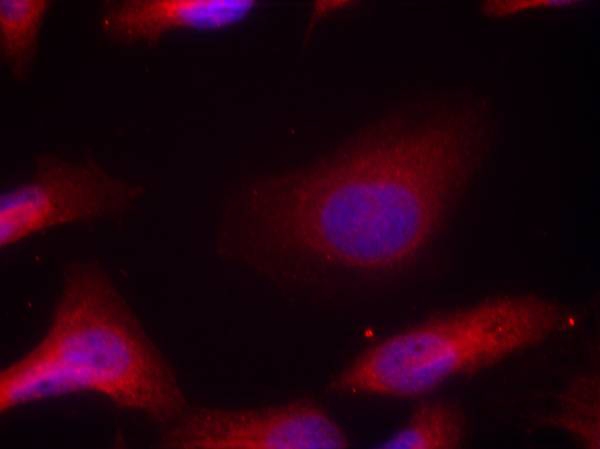 Src(Phospho-Tyr529) Antibody