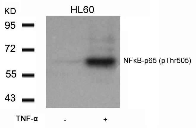 NFkB-p65(Phospho-Thr505) Antibody