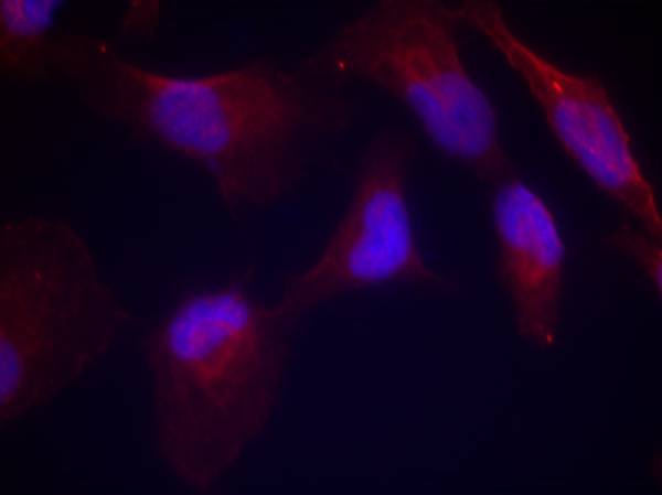 SEK1/MKK4(Phospho-Thr261) Antibody