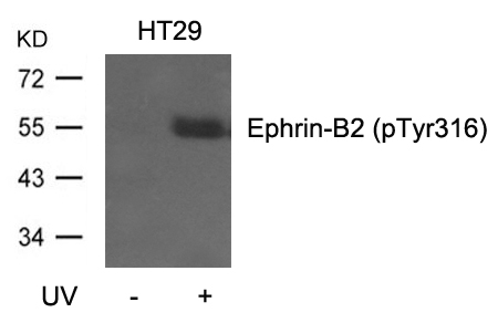 Ephrin-B2(Phospho-Tyr316) Antibody
