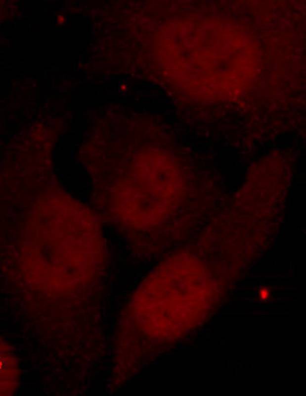 HDAC2(Phospho-Ser394) Antibody