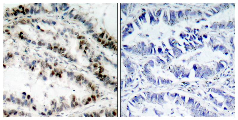 SMC1(Phospho-Ser957) Antibody