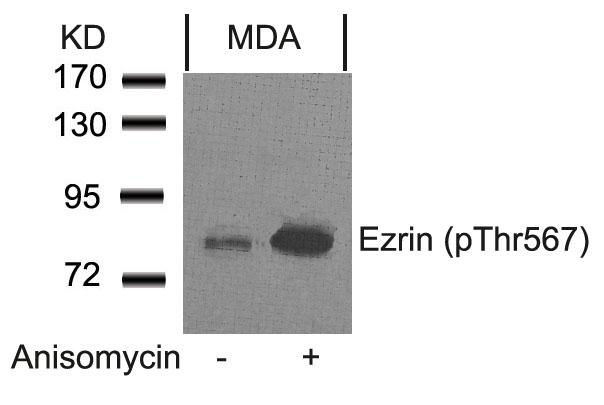 Ezrin(Phospho-Thr567) Antibody